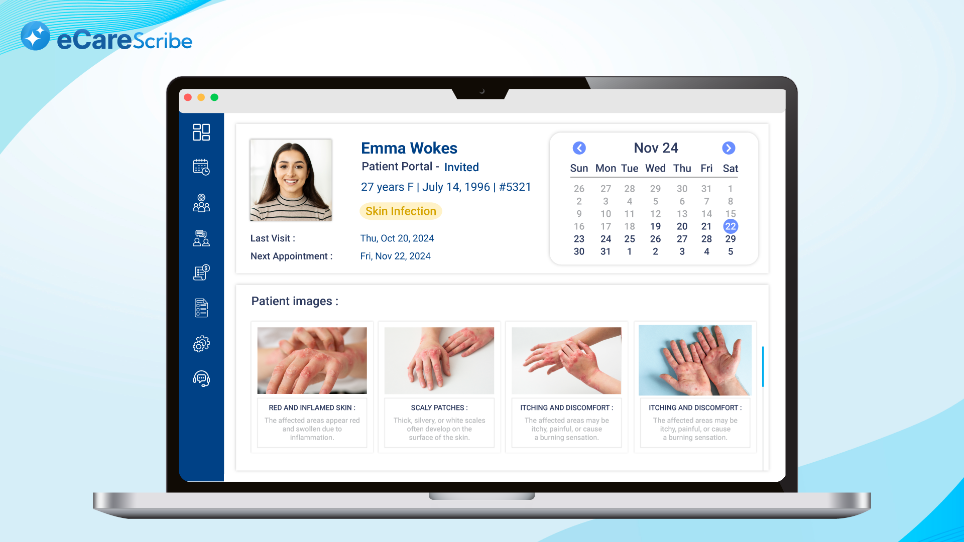 Enhancing Documentation and Workflow Efficiency in Dermatology through AI Notetaker Implementation image